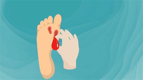 釘子扎了一個(gè)小口子要打破傷風(fēng)嗎(釘子扎個(gè)小傷口用打破傷風(fēng)么)縮略圖