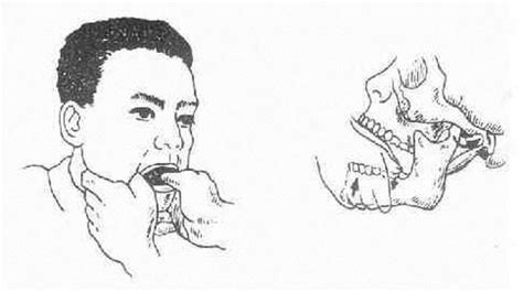 掛鉤疼張不開嘴怎么辦,掛鉤疼張不開嘴怎么辦應(yīng)該掛什么科縮略圖