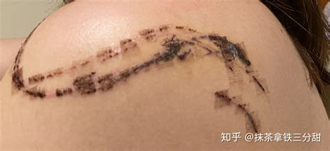 紋身貼洗不掉怎么辦,紋身貼洗不掉怎么辦有什么方法縮略圖