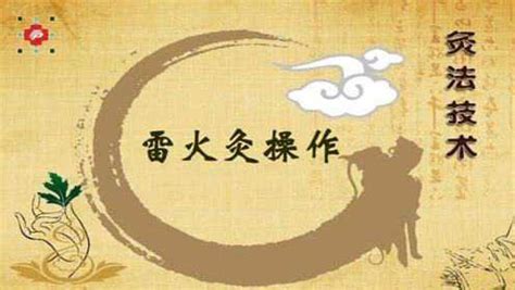 雷火灸操作視頻手法,雷火灸的操作流程視頻縮略圖