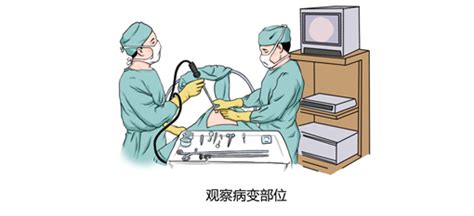 胸交感神經切斷(胸交感神經切斷術危害)縮略圖